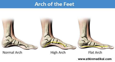 best arch support for kids